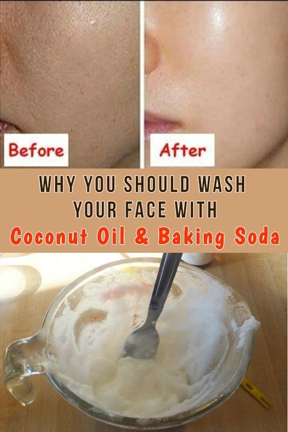 BAKING SODA AND COCONUT OIL FACE MASK FOR ACNE SCARS Cooky & Foody