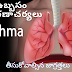 Asthma treatment at home