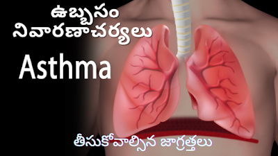 asthma asthma symptoms asthma treatment asthma bronchitis asthma with bronchitis asthma inhaler asthma causes what asthma is asthma meaning asthma definition what asthma causes asthma medications asthma types asthma pump asthma pronunciation asthma with allergies asthma pathophysiology asthma allergy asthma attack asthma in hindi is asthma curable asthma cure asthma yoga asthma hindi asthma icd 10 asthma hindi meaning asthma disease asthma slideshare asthma is caused by asthma ppt