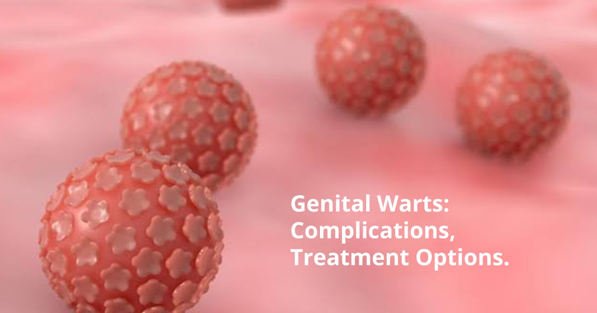 Genital Warts Complications and Treatment Options Metromale Clinic