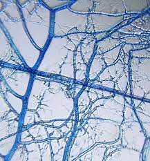 Mycelia sterilia Mycelia sterilia
