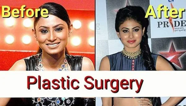 मौनी रॉय plastic surgery now and then