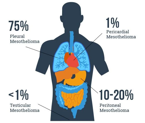 Gorgeous 4 Types Of Mesothelioma Capture Nature Gorgeous 4 Types Of Mesothelioma Capture Nature