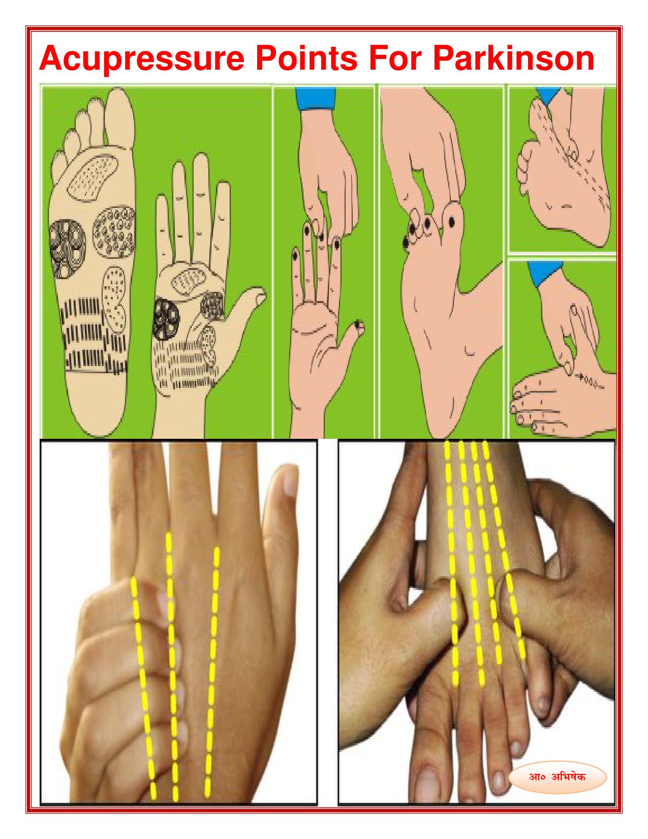 कम्पवात / पार्किंसन / पार्किंसंस के लिए एक्यूप्रेशर बिंदु (Acupressure