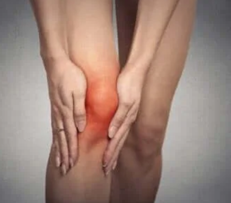 Features of patellar chondrosis
