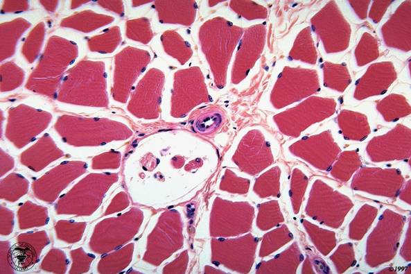 ESTRUCTURA DEL MÚSCULO ESQUELÉTICO | Guía para GLOBEROS con PULSOMETRO