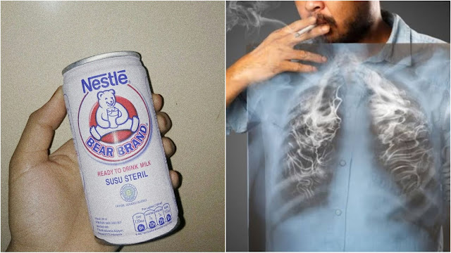 Bukan Air Soda, Tapi Susu Beruang yang Mampu Membersihkan Paru-Paru Secara Alami, Dijamin Gak Akan Sesak-sesak Lagi