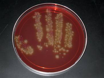 Medical Laboratory and Biomedical Science: Targeted Screening for C ...