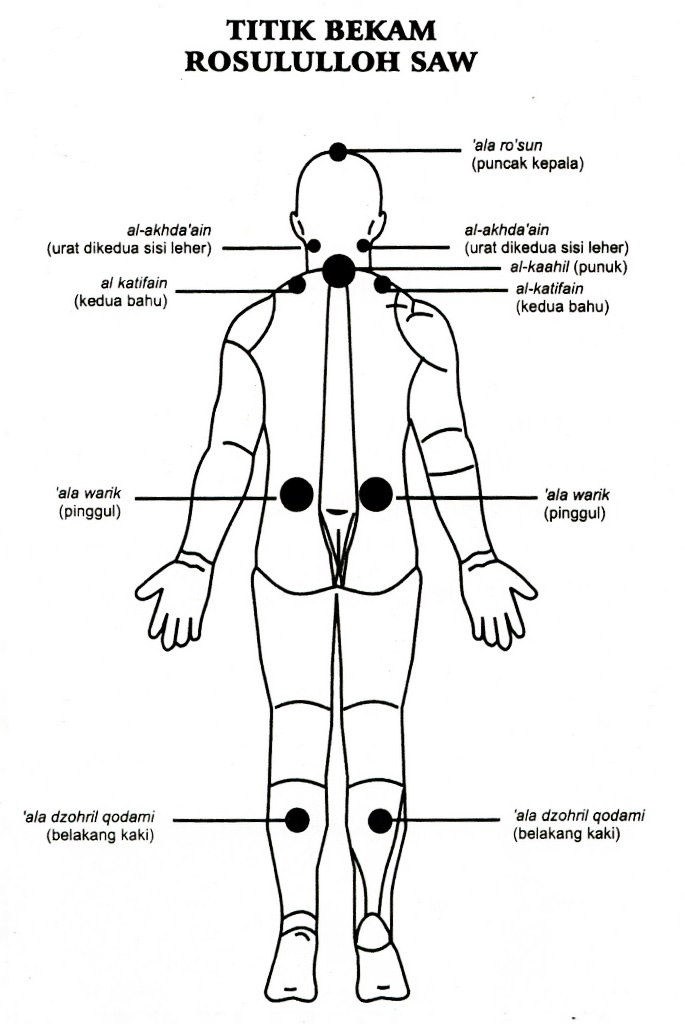 Titik Bekam Mata Minus - Perumperindo.co.id