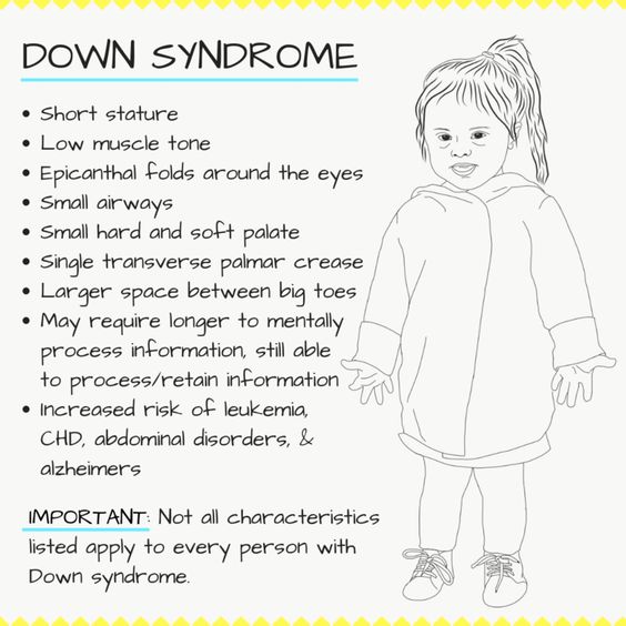 Chromosomal Disorder's - Down Syndrome 12th Biology