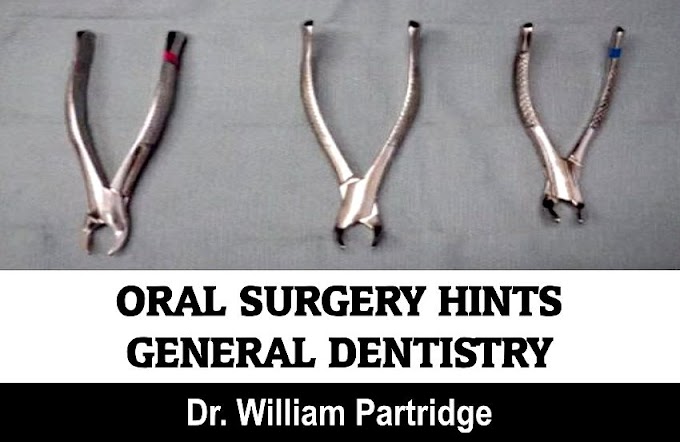 ORAL SURGERY Hints - General Dentistry - Dr. William Partridge