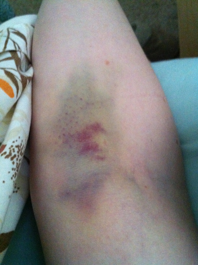 Life as an AmeriCanadian Update to 11 Donating Blood