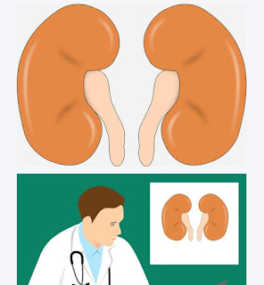 Kidney problem kidney stone
