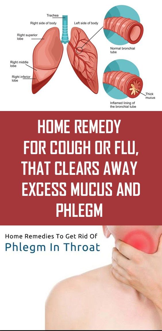 Home Remedy For Cough Or Flu, That Clears Away Excess Mucus & Phlegm