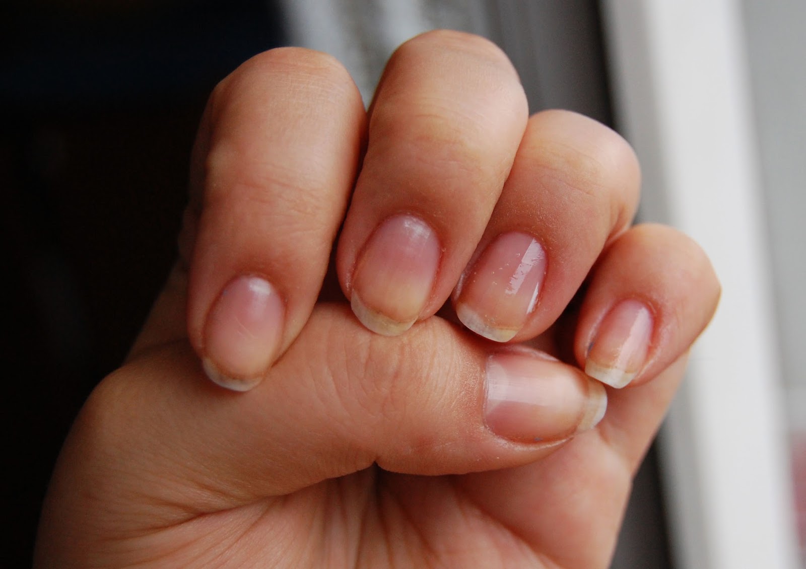 kuracja-nail-tek kuracja-nail-tek