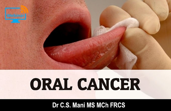 WEBINAR: ORAL CANCER -  Dr C.S.Mani MS MCh FRCS