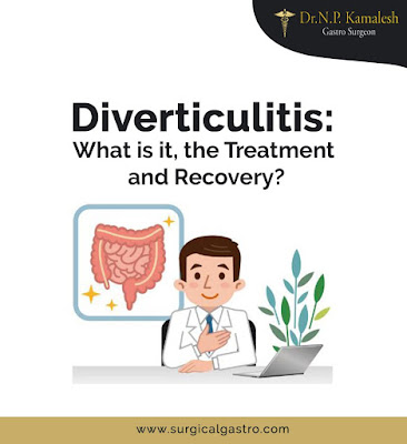  Diverticulitis