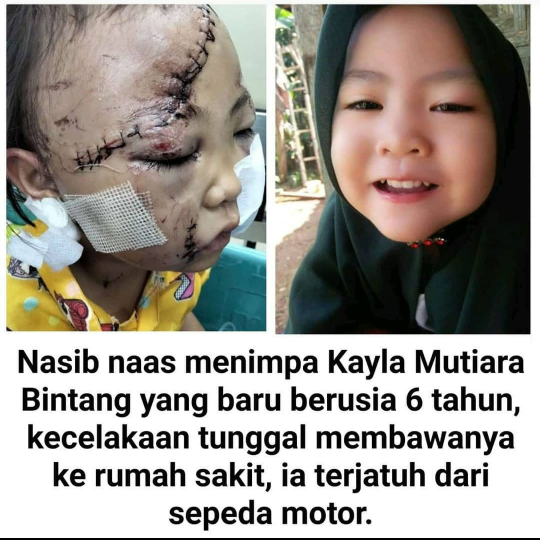 jatuh dari motor