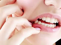 Cara Menyembuhkan Sakit Gigi Menggunakan Metode Tradisional