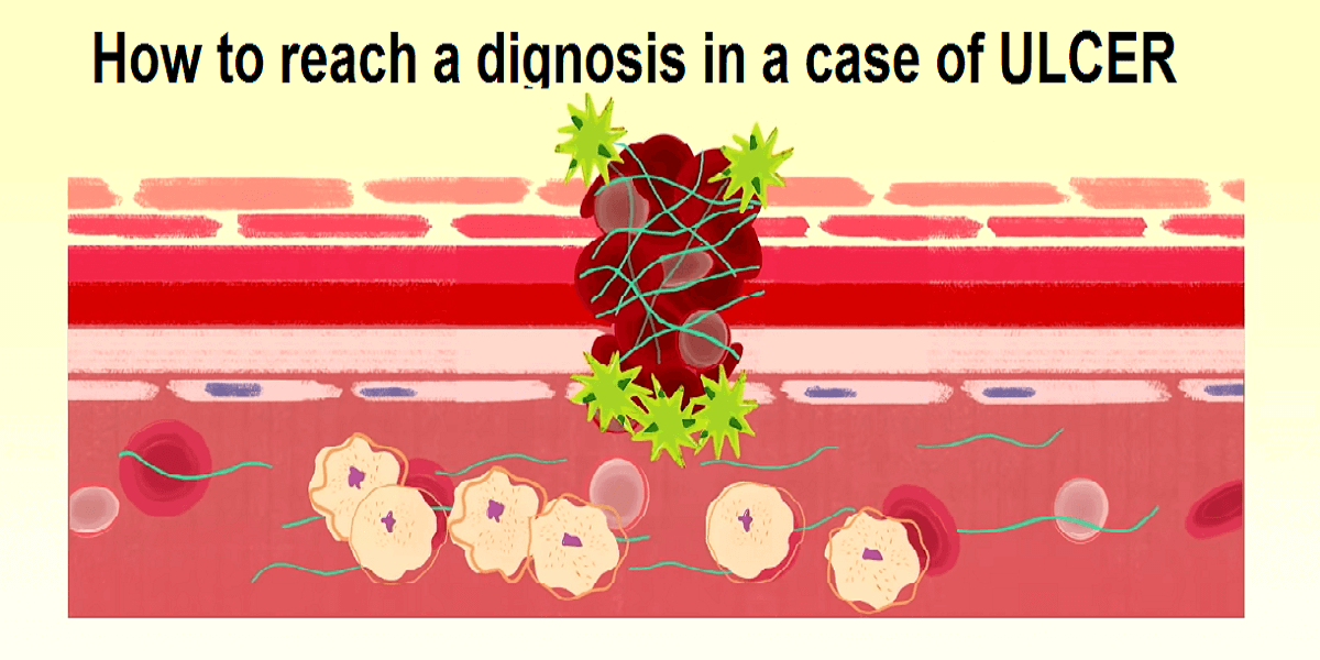 Ulcers Examination, Defferential Diagnosis and how to diagnose