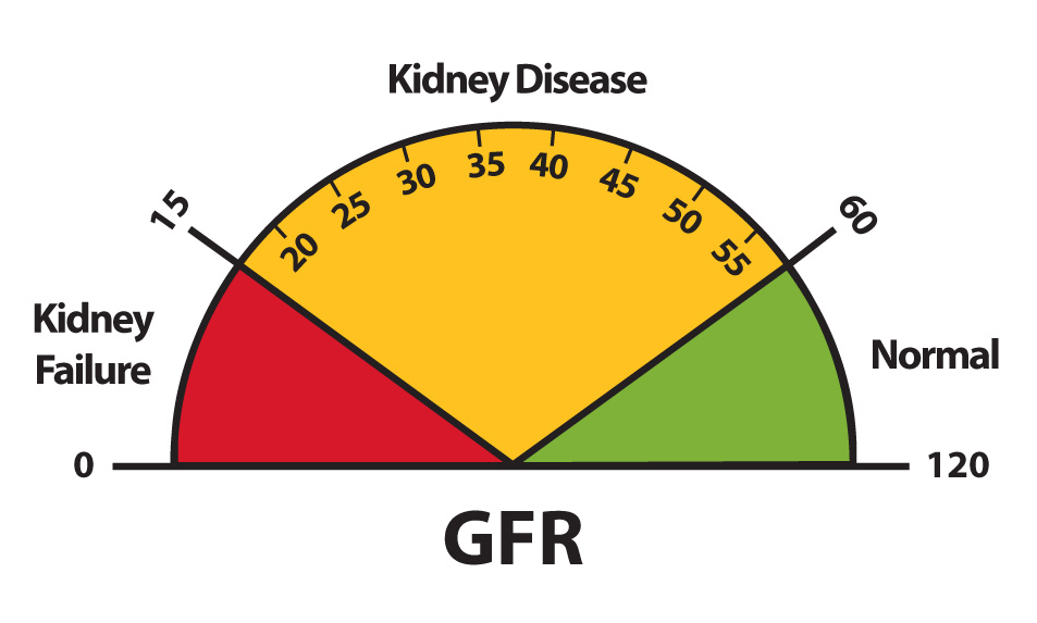 estimated-glomerular-filtration-rate-egfr-in-2020-chronic-kidney