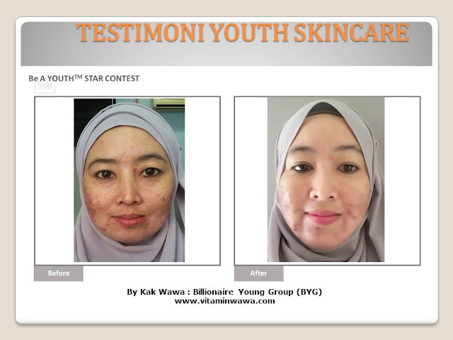 34 Testimoni Youth Skincare Shaklee Terbaru, Youth skincare shaklee, testimoni youth skincare shaklee, Youth Skincare Shaklee : Harga dan Review Pengguna Youth Shaklee, testimoni youth skincare shaklee, testimoni youth skincare shaklee 34 Testimoni Youth Skincare Shaklee Terbaru, Youth skincare shaklee, testimoni youth skincare shaklee, Youth Skincare Shaklee : Harga dan Review Pengguna Youth Shaklee, testimoni youth skincare shaklee, testimoni youth skincare shaklee