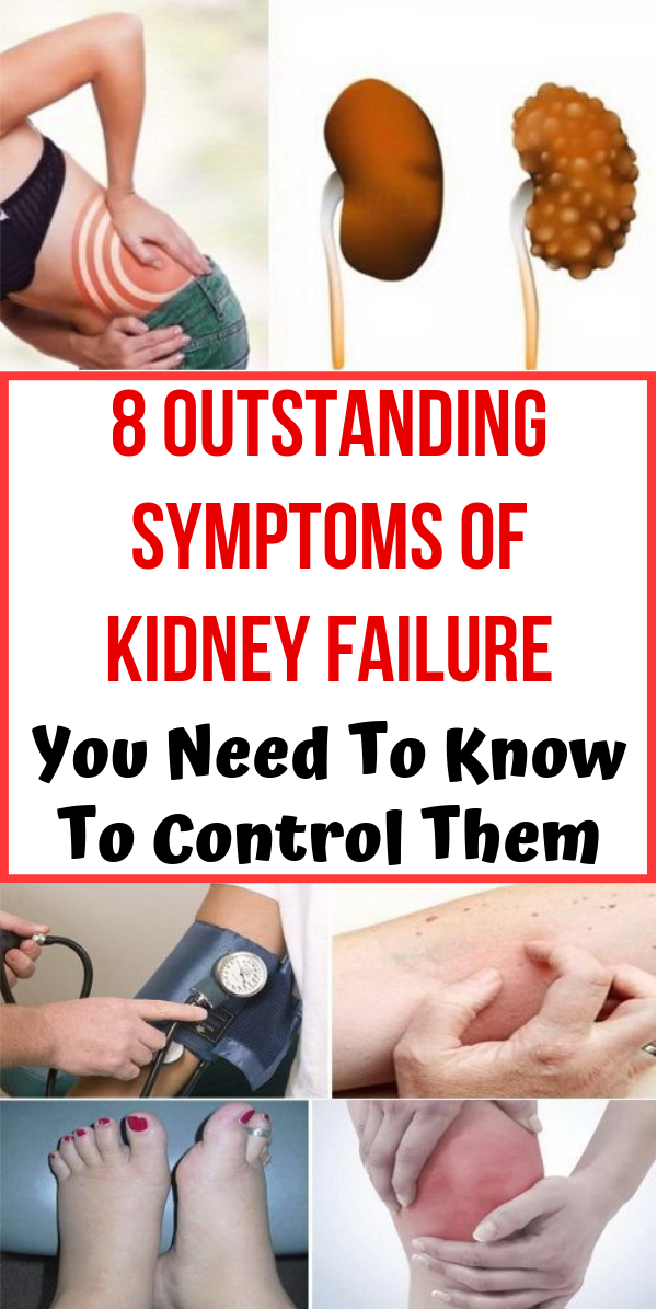 8-outstanding-symptoms-of-kidney-failure-you-need-to-know-to-control-them