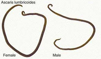 Nemathelminthes ascaris, Ascaris lumbricoides (orsógiliszta) | Körinfo