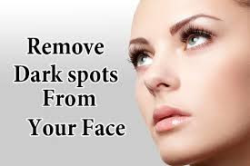 remove-dark-spots-on-face