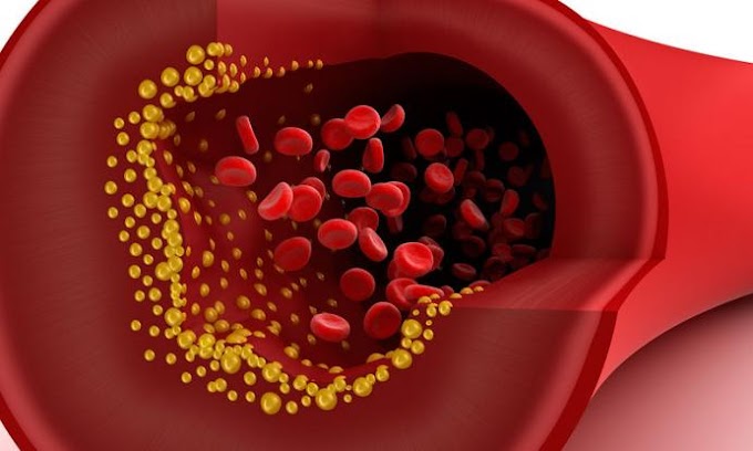 Χοληστερόλη: Το μεγάλο λάθος που κάνουν όσοι ξεκινούν να παίρνουν φάρμακα