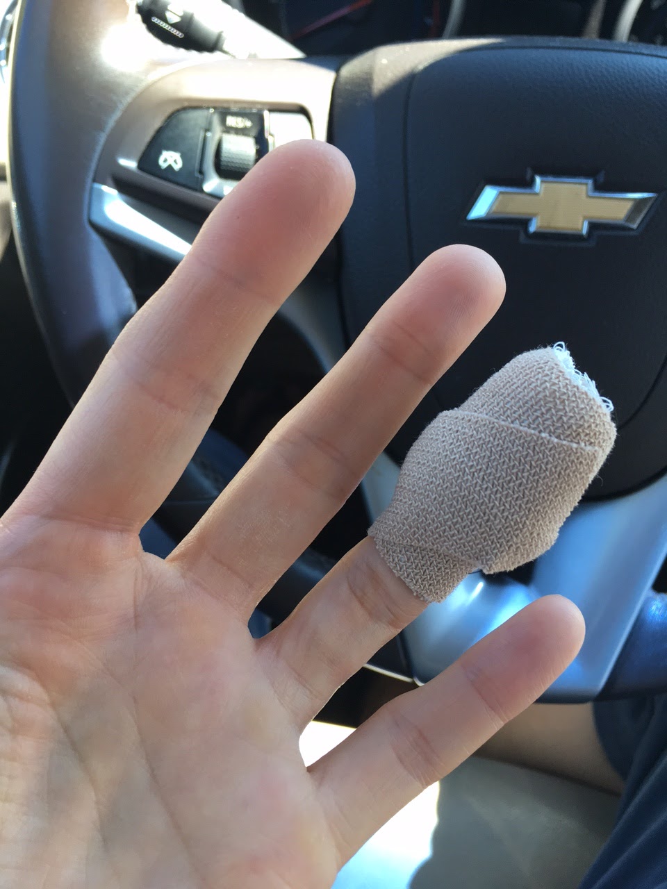 Amy Finds the Joy How to Remove a Glass Sliver From Your Finger in 12