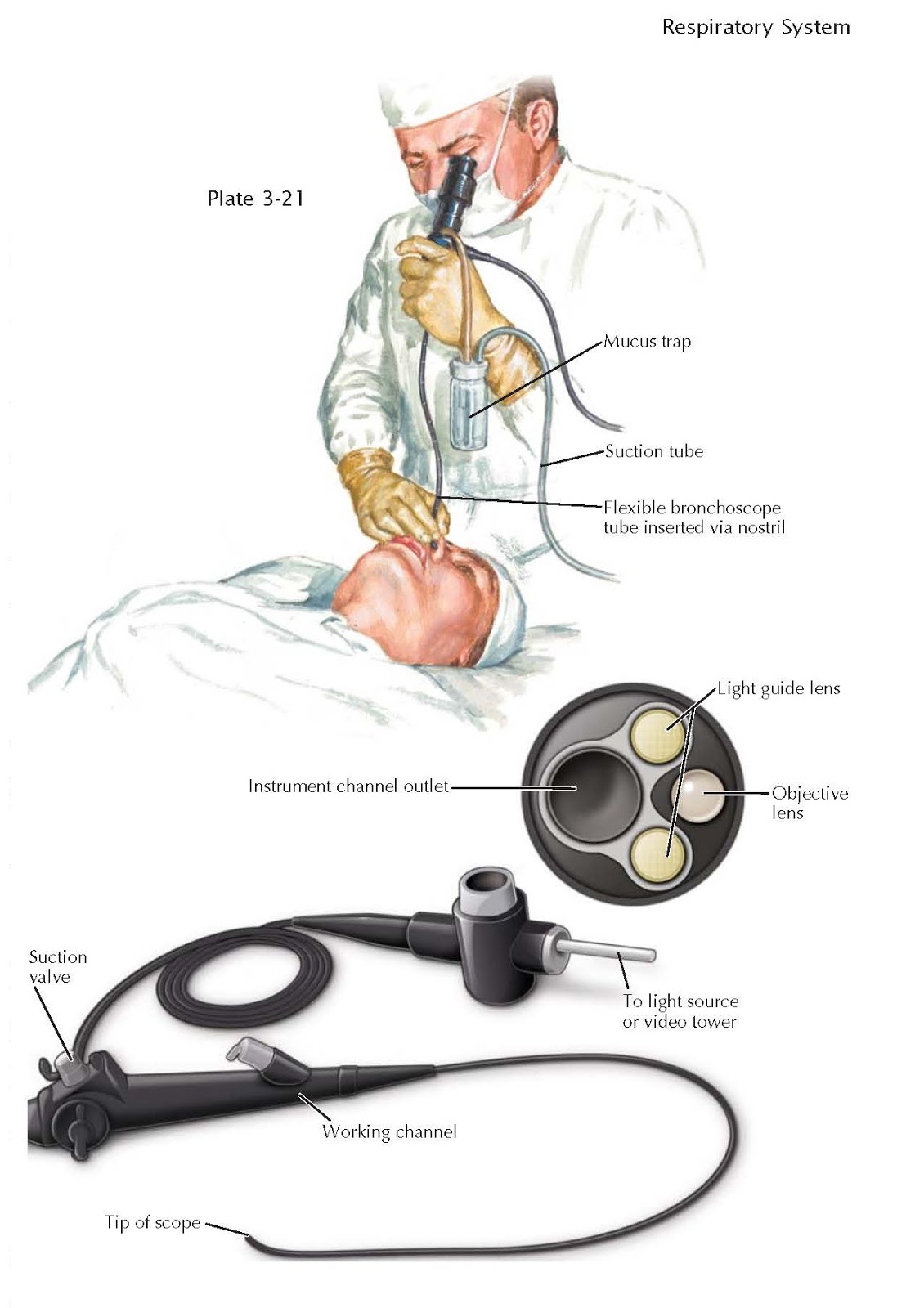 FLEXIBLE BRONCHOSCOPY pediagenosis