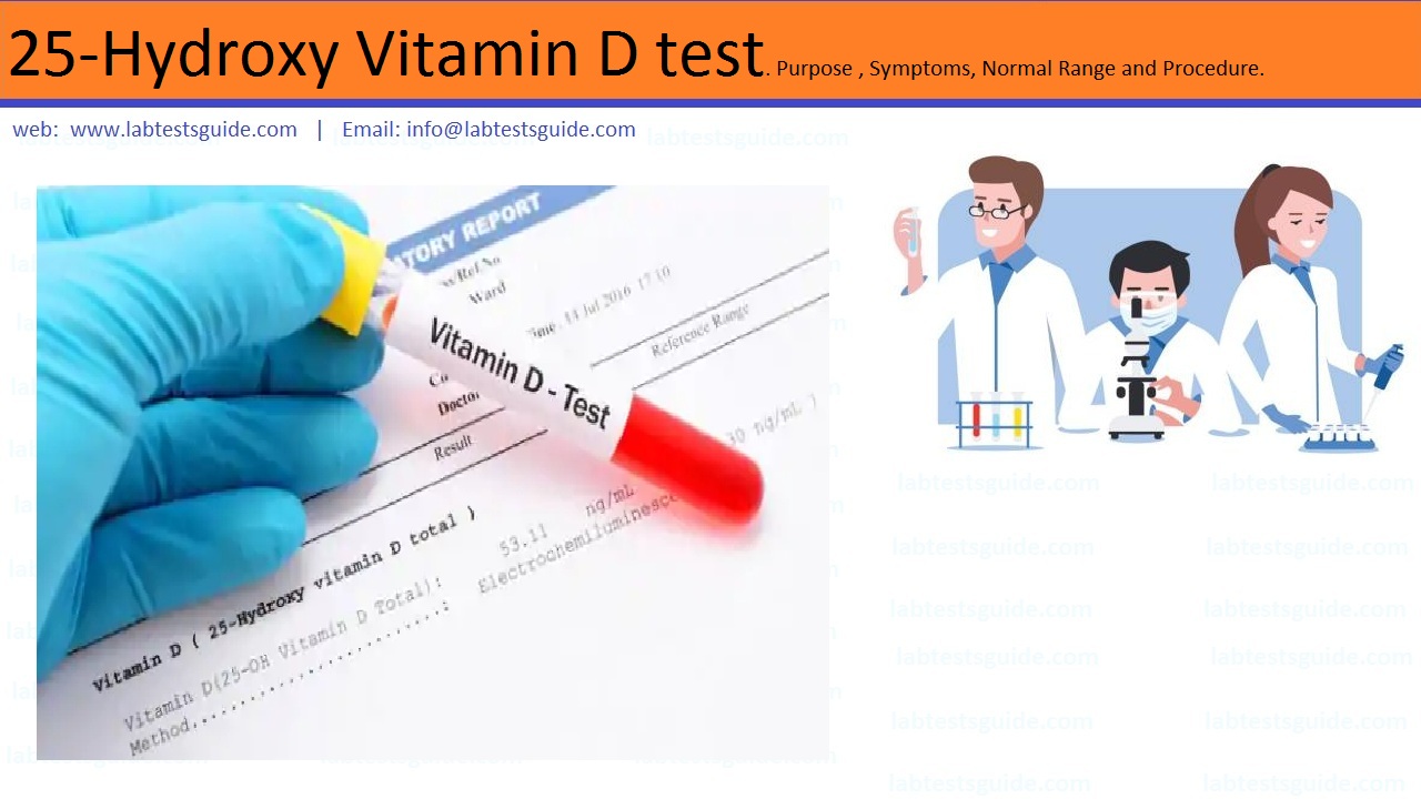 25-Hydroxy Vitamin D Test