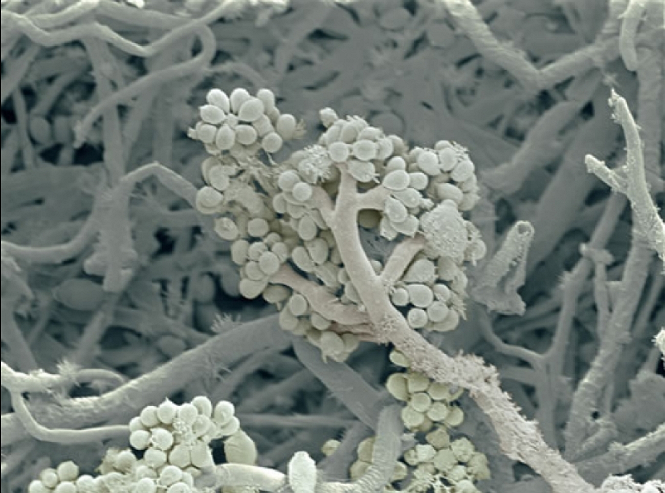 Патогенные грибы споры. Аспергилл кандида. Патогенные микроскопические грибы.
