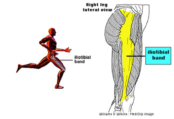 Iliotibial+Band.jpg