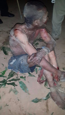4 Man attacked by youths in Abia after they claimed he was a wizard (photos)