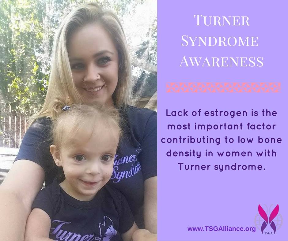 My Turner Syndrome Journey ABOUT TURNER SYNDROME