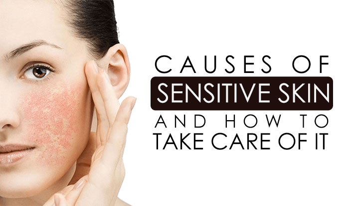Causes of Sensitive Skins and How to Take Care of it