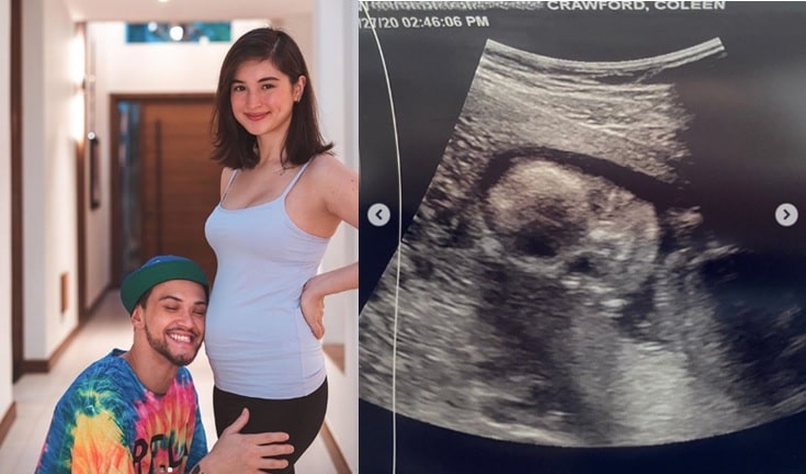 Billy Crawford and Coleen Garcia expecting first child