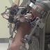 RiceWrist: νέος exoskeleto​n για την αποκατάστα​ση