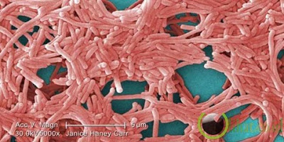 Makalah Bakteri Lengkap Dengan Gambarnya Makalah Bakteri Lengkap Dengan Gambarnya