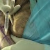 Médico brasileiro faz cirurgia plástica em si mesmo (vídeo)