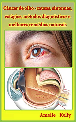 Câncer de olho - causas, sintomas, estágios, métodos diagnósticos e melhores remédios naturais Câncer de olho - causas, sintomas, estágios, métodos diagnósticos e melhores remédios naturais