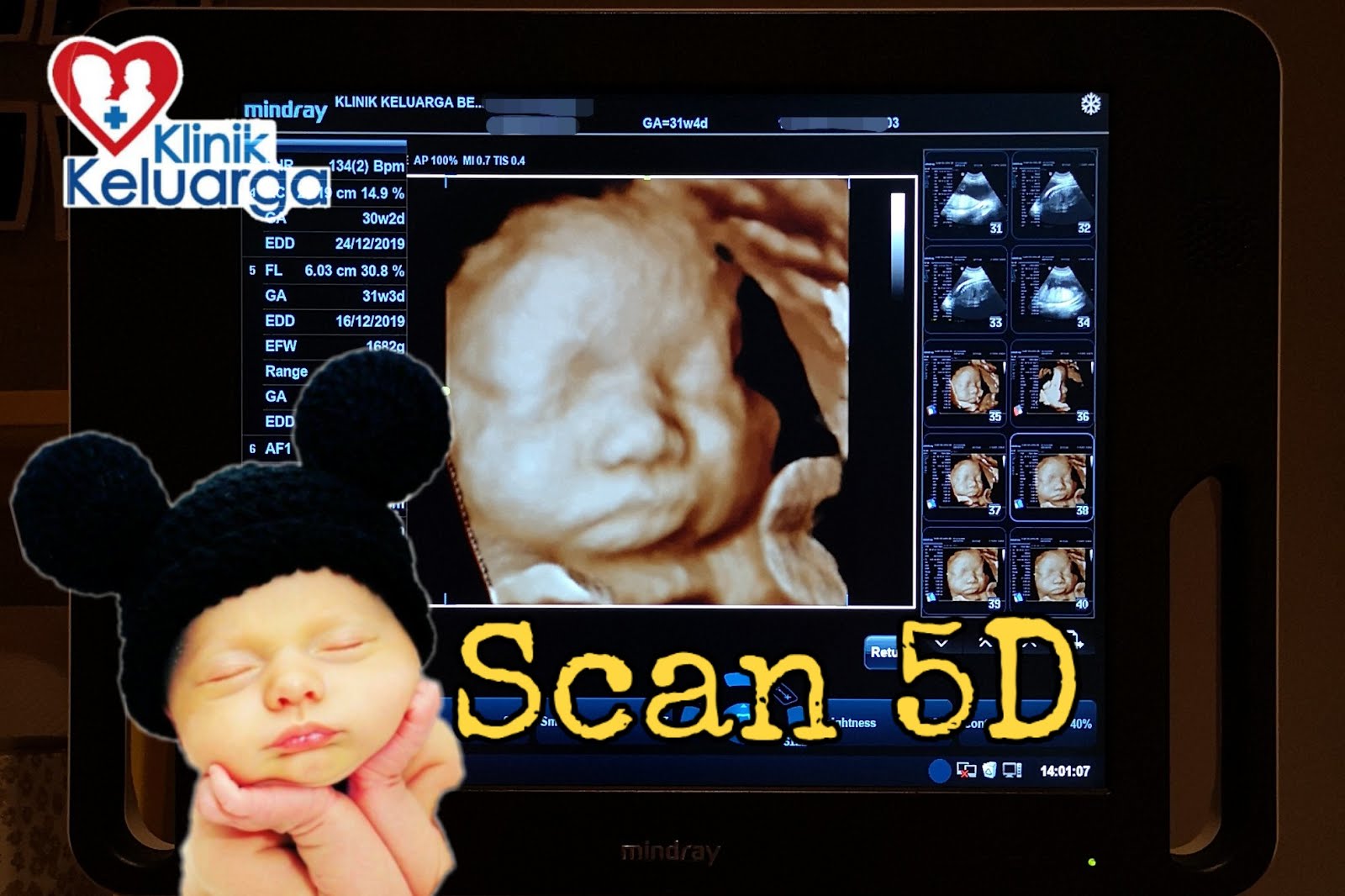 scan 5d