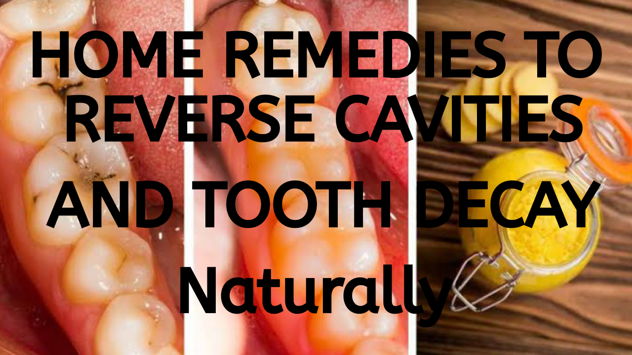 How to Heal Cavities and Tooth Decay Naturally Home Remedies