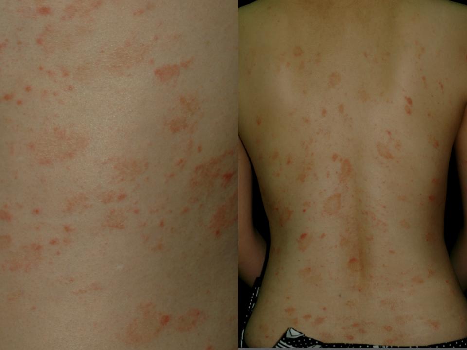 clinica de viermi