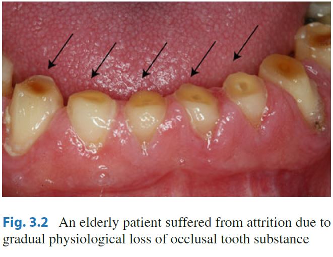 Dentosphere World of Dentistry Tooth Sensitivity / Dentin