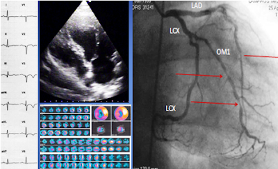 Cardiology book and cardiology cases