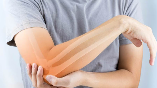 أعراض نقص الكالسيوم