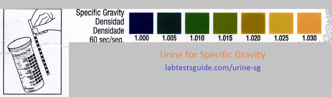 urine specific gravity lab value